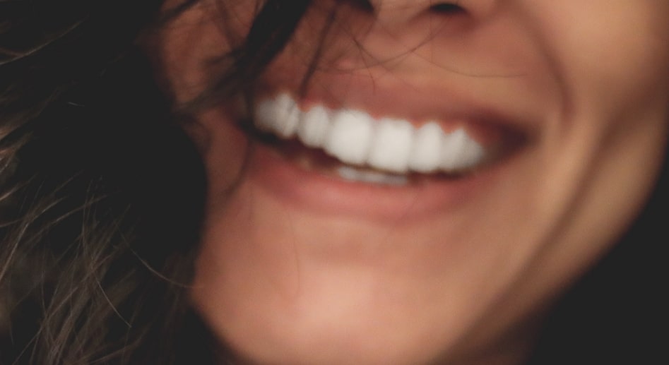 Woman smiling showing her teeth before sedation dentistry in Waterloo